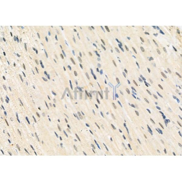 FAM96B Antibody - DF12272 at 1/100 staining Rat heart tissue by IHC-P.