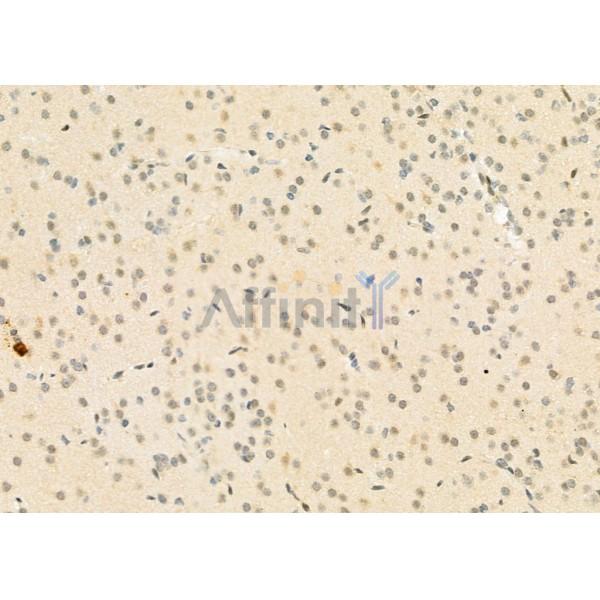 FAM96B Antibody - DF12272 at 1/100 staining Rat brain tissue by IHC-P.