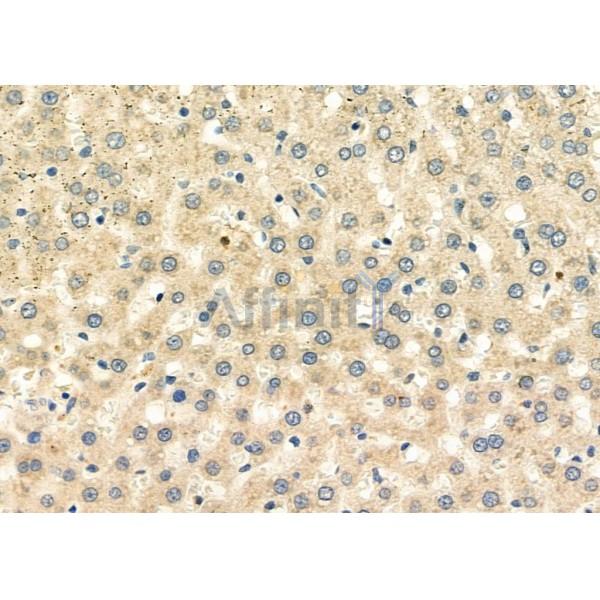 HBXIP Antibody - DF12276 at 1/100 staining Rat liver tissue by IHC-P.