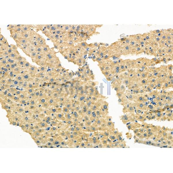 HERP Antibody - DF12278 at 1/100 staining Mouse liver tissue by IHC-P.