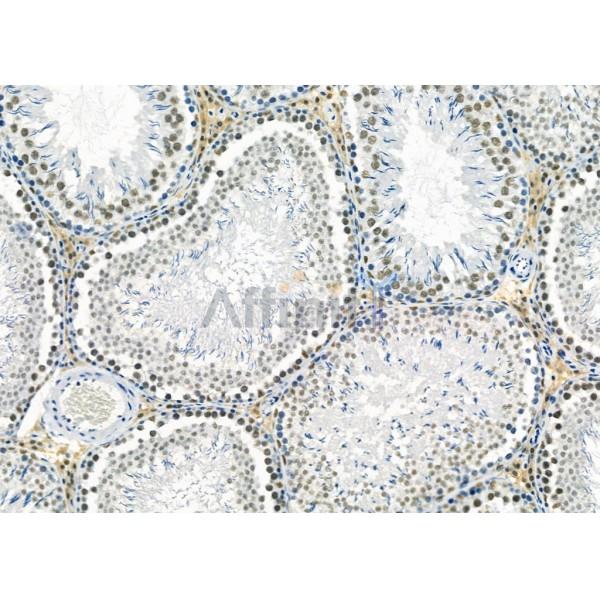 HRP2 Antibody - DF12282 at 1/100 staining Rat testis tissue by IHC-P.