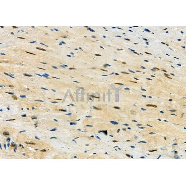 HRP2 Antibody - DF12282 at 1/100 staining Mouse heart tissue by IHC-P.