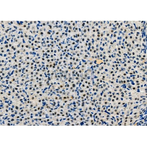 HRP2 Antibody - DF12282 at 1/100 staining Mouse ovarian tissue by IHC-P.