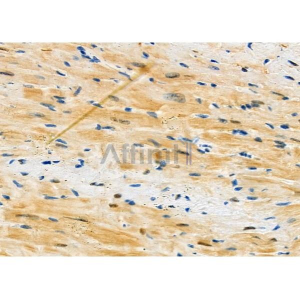 Mast Cell Chymase Antibody - DF12290 at 1/100 staining Mouse heart tissue by IHC-P.