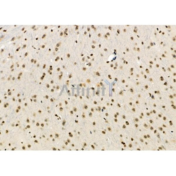 MEPCE Antibody - DF12294 at 1/100 staining Mouse brain tissue by IHC-P.