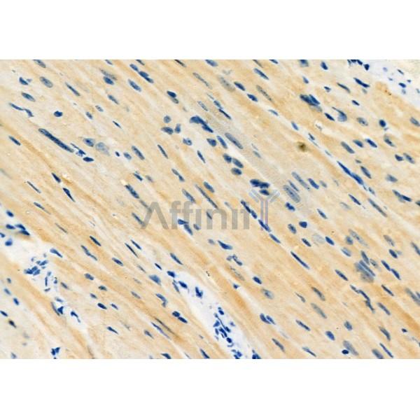 MEST Antibody - DF12295 at 1/100 staining Mouse heart tissue by IHC-P.