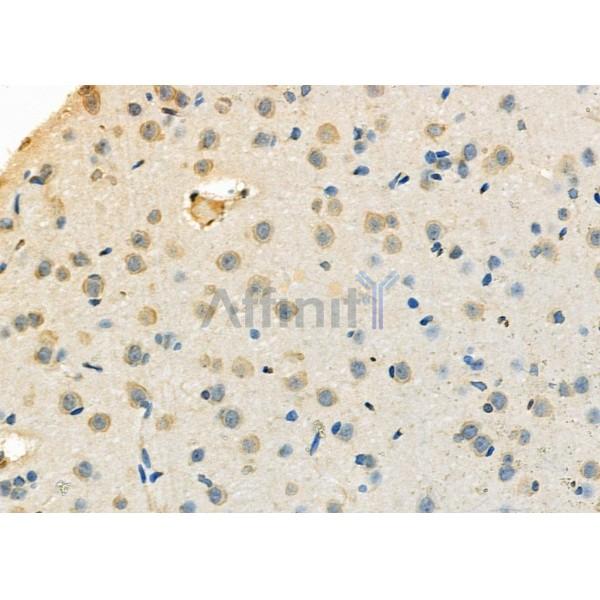 NA14 Antibody - DF12299 at 1/100 staining Rat brain tissue by IHC-P.