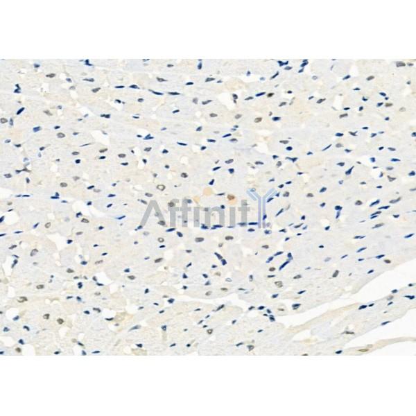 NDUFS7 Antibody - DF12301 at 1/100 staining Rat heart tissue by IHC-P.