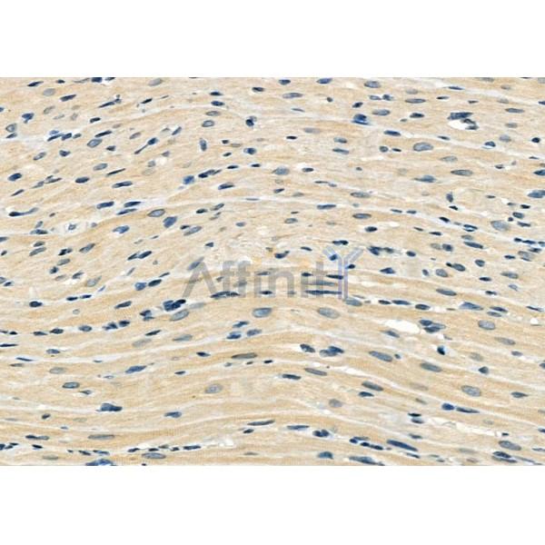 STAU1 Antibody - DF12325 at 1/100 staining Rat heart tissue by IHC-P.