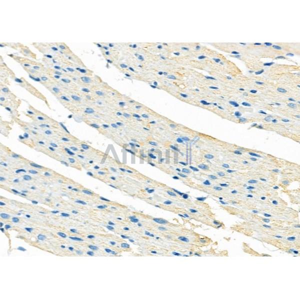 STBD1 Antibody - DF12326 at 1/100 staining Rat muscle tissue by IHC-P.