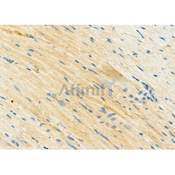 STBD1 Antibody - DF12326 at 1/100 staining Mouse heart tissue by IHC-P.