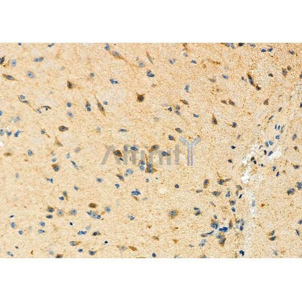 STBD1 Antibody - DF12326 at 1/100 staining Mouse brain tissue by IHC-P.