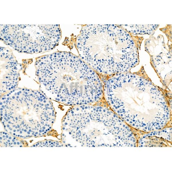TIMM44 Antibody - DF12332 at 1/100 staining Mouse testis tissue by IHC-P.