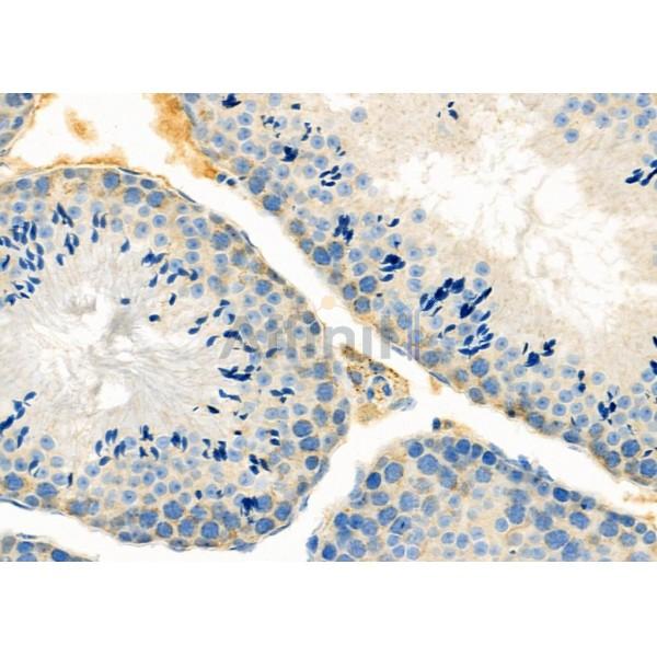 UQCRC1 Antibody - DF12338 at 1/100 staining Mouse testis tissue by IHC-P.