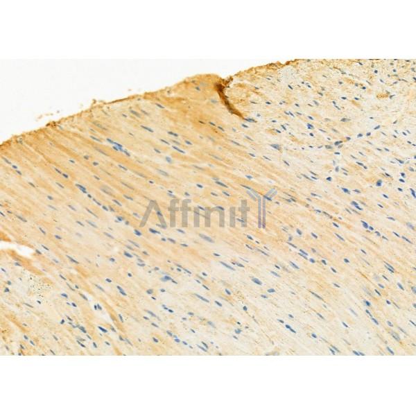 UQCRC1 Antibody - DF12338 at 1/100 staining Mouse heart tissue by IHC-P.