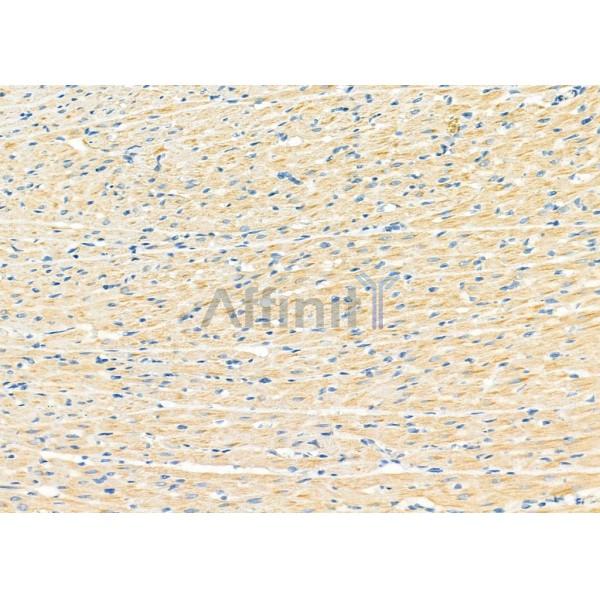 UQCRC1 Antibody - DF12338 at 1/100 staining Rat heart tissue by IHC-P.