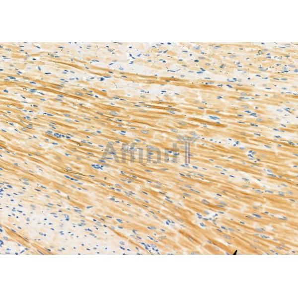 ARL8B Antibody - DF12350 at 1/100 staining Rat heart tissue by IHC-P.