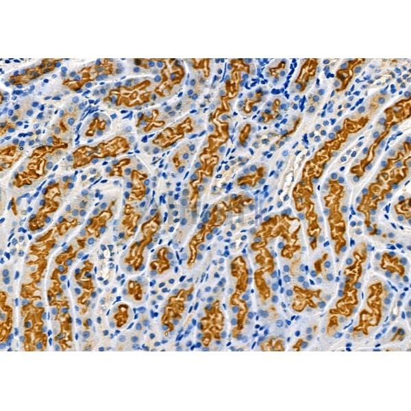 BBS4 Antibody - DF12358 at 1/100 staining Mouse kidney tissue by IHC-P.