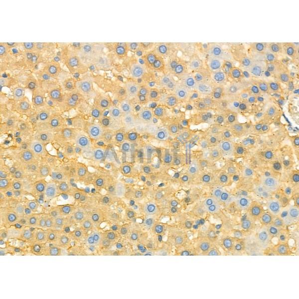 CNPY2/MSAP Antibody - DF12367 at 1/100 staining Rat liver tissue by IHC-P.