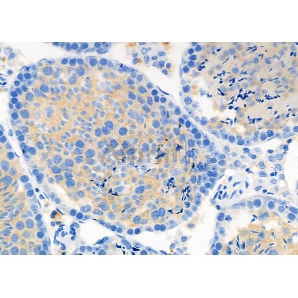 DIO1 Antibody - DF12382 at 1/100 staining Mouse testis tissue by IHC-P.