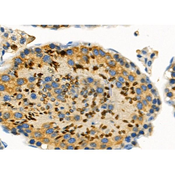 DOM3Z Antibody - DF12385 at 1/100 staining Mouse testis tissue by IHC-P.