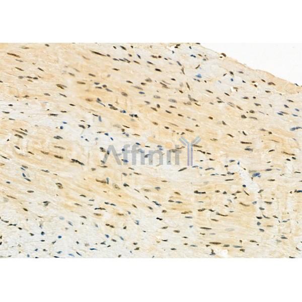 LRPPRC Antibody - DF12421 at 1/100 staining Mouse heart tissue by IHC-P.