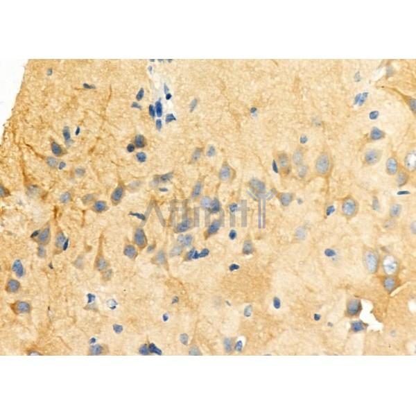 MAP1B Antibody - DF12422 at 1/100 staining Rat brain tissue by IHC-P.