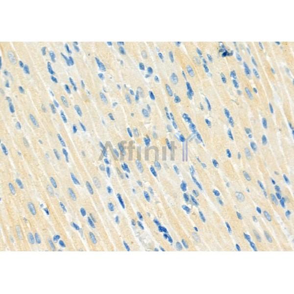 MRFAP1 Antibody - DF12424 at 1/100 staining Rat heart tissue by IHC-P.