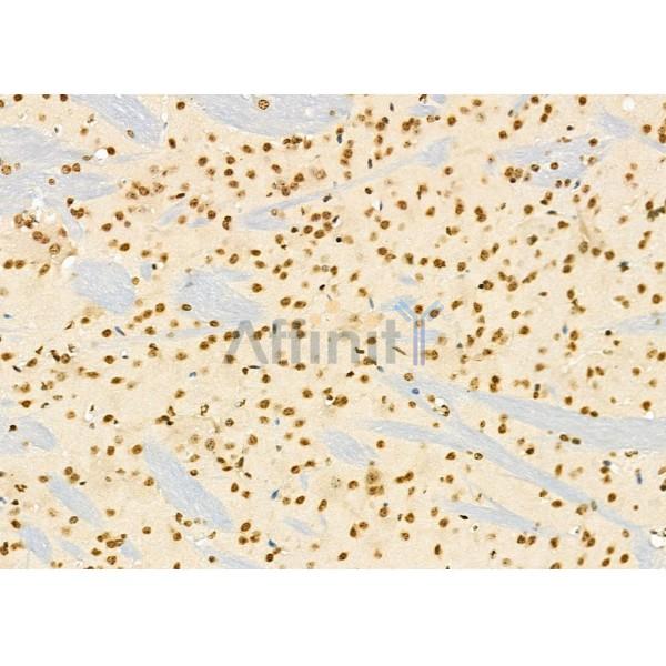 NR1D1 Antibody - DF12430 at 1/100 staining Mouse brain tissue by IHC-P.