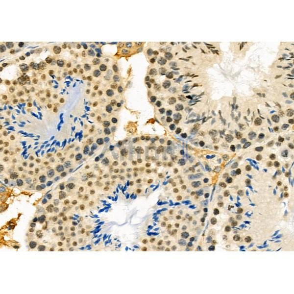 NR1D1 Antibody - DF12430 at 1/100 staining Mouse testis tissue by IHC-P.