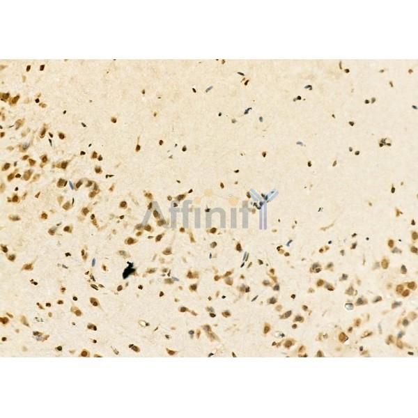NR1D1 Antibody - DF12430 at 1/100 staining Rat brain tissue by IHC-P.