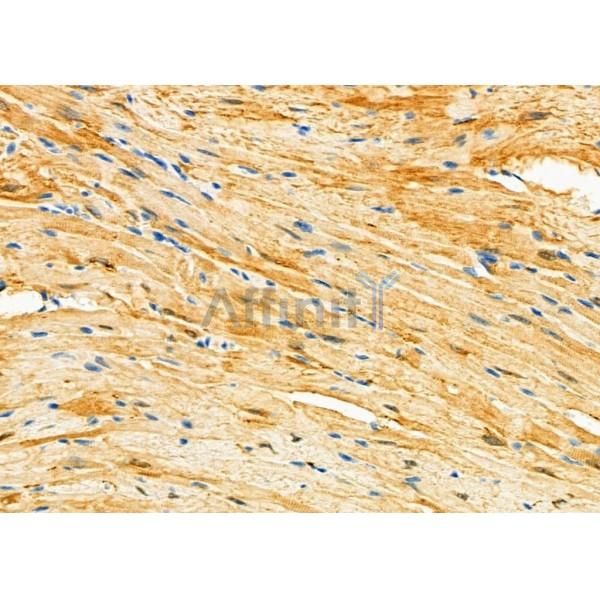 Oligophrenin 1 Antibody - DF12434 at 1/100 staining Mouse heart tissue by IHC-P.