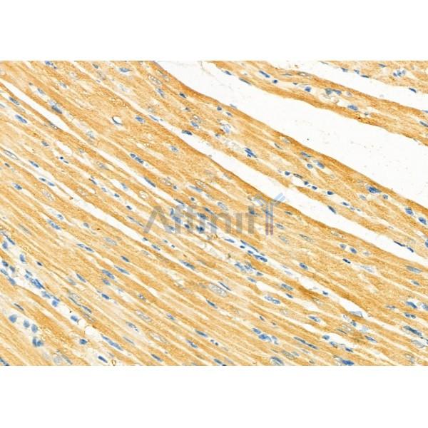 Oligophrenin 1 Antibody - DF12434 at 1/100 staining Rat heart tissue by IHC-P.