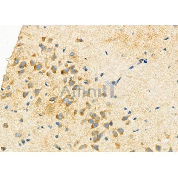 P4HA2 Antibody - DF12440 at 1/100 staining Rat brain tissue by IHC-P.