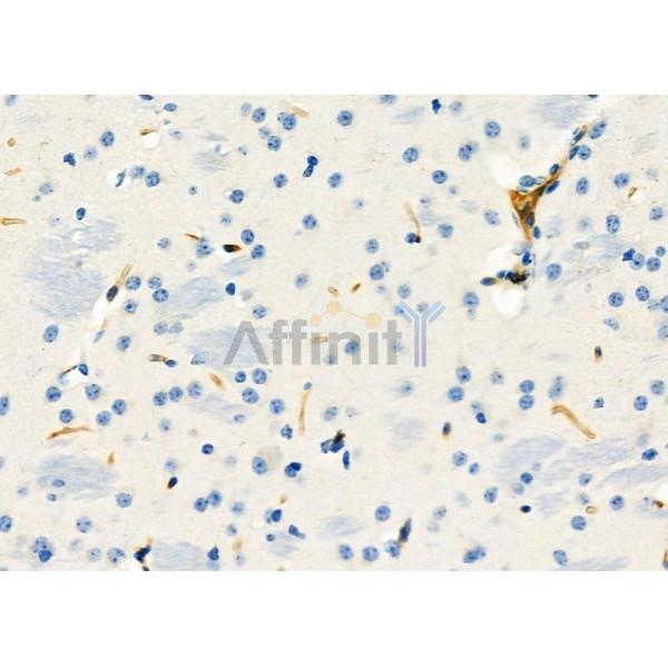 PIK3IP1 Antibody - DF12453 at 1/100 staining Mouse brain tissue by IHC-P.