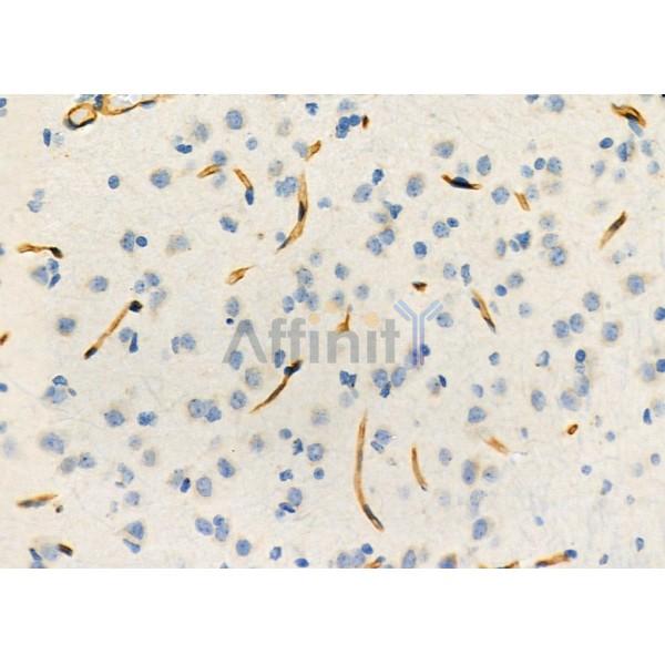 PIK3IP1 Antibody - DF12453 at 1/100 staining Rat brain tissue by IHC-P.