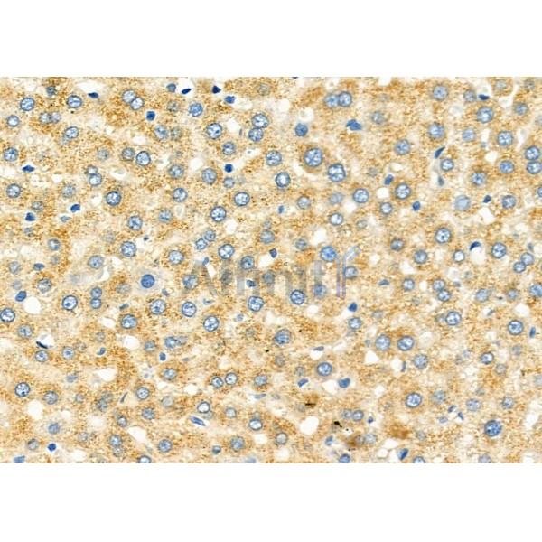 PTP4A1/PRL1 Antibody - DF12458 at 1/100 staining Rat liver tissue by IHC-P.
