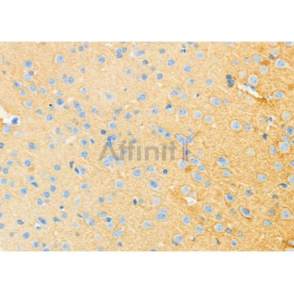 Rab3A Antibody - DF12461 at 1/100 staining Mouse brain tissue by IHC-P.