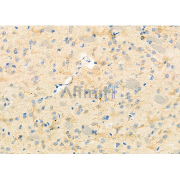RBBP9 Antibody - DF12462 at 1/100 staining Mouse brain tissue by IHC-P.