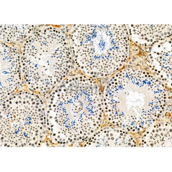 SMYD3 Antibody - DF12477 at 1/100 staining Mouse testis tissue by IHC-P.