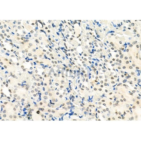SMYD3 Antibody - DF12477 at 1/100 staining Rat kidney tissue by IHC-P.