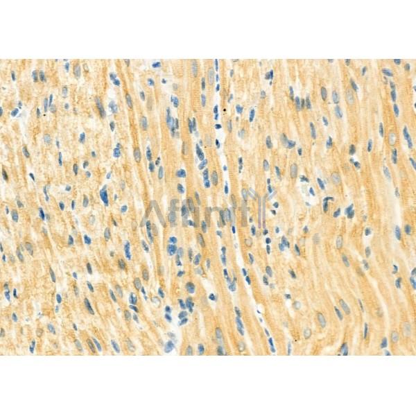 SPAG4L Antibody - DF12478 at 1/100 staining Rat heart tissue by IHC-P.