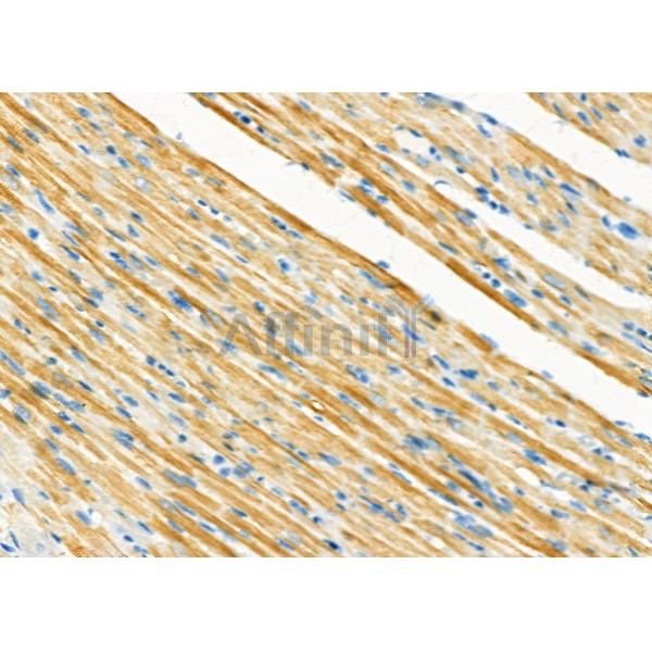 UFD1L Antibody - DF12494 at 1/100 staining Rat heart tissue by IHC-P.