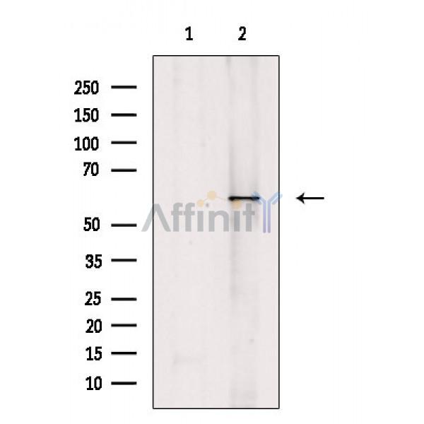 CACNB4 Antibody - Western blot analysis of extracts from A549 cells, using CACNB4 Antibody.