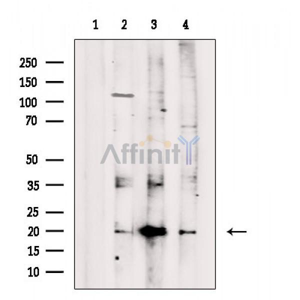 GKN2 Antibody - Western blot analysis of extracts from various samples, using GKN2 Antibody.