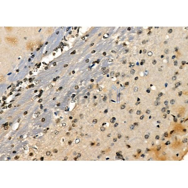 E2F7 Antibody - DF2444 at 1/100 staining Mouse brain tissue by IHC-P.