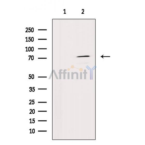 IL12RB1 Antibody - Western blot analysis of extracts from Rat brain, using IL12RB1 Antibody.
