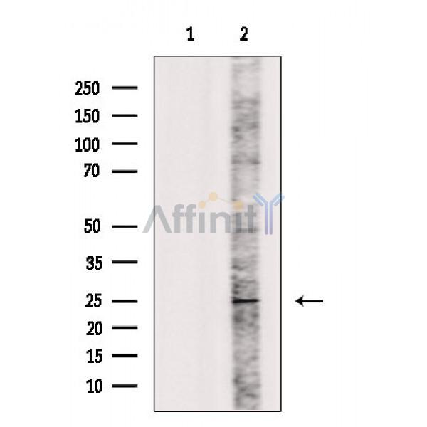 IL1F6 Antibody - Western blot analysis of extracts from Mouse liver, using IL1F6 Antibody.