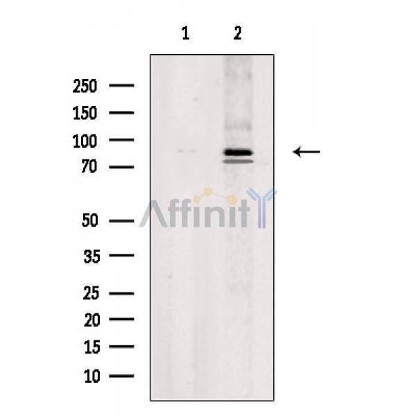 ITGB6 Antibody - Western blot analysis of extracts from A549 cells, using ITGB6 Antibody.