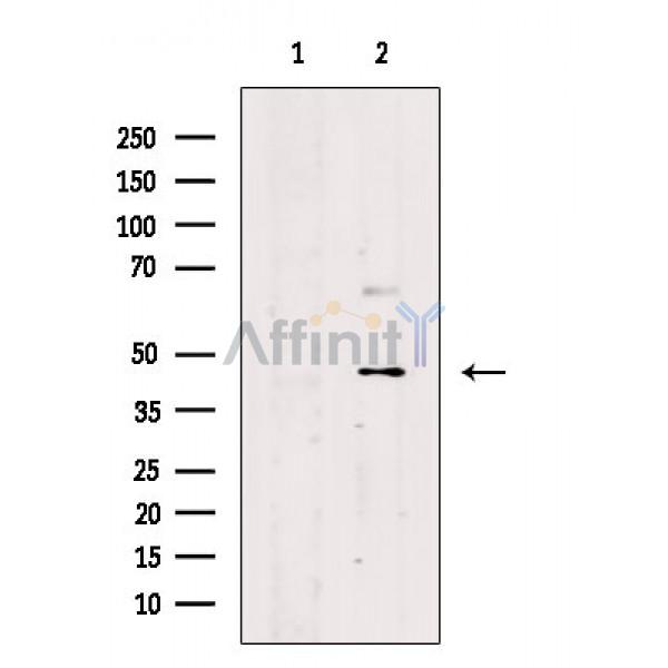 CANT1 Antibody - Western blot analysis of extracts from Rat brain, using CANT1 Antibody.